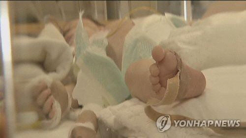 신생아 환자[연합뉴스]